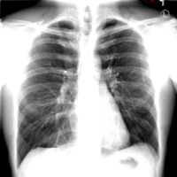 Ethan's X-Rays