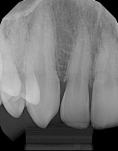 xrays of my teeth 4