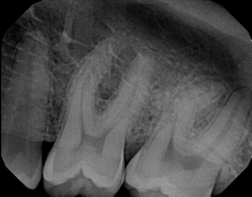 xrays of my teeth 7