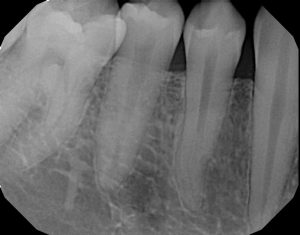 xrays of my teeth 8