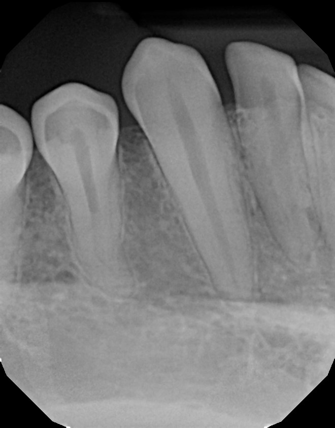 xrays of my teeth 9