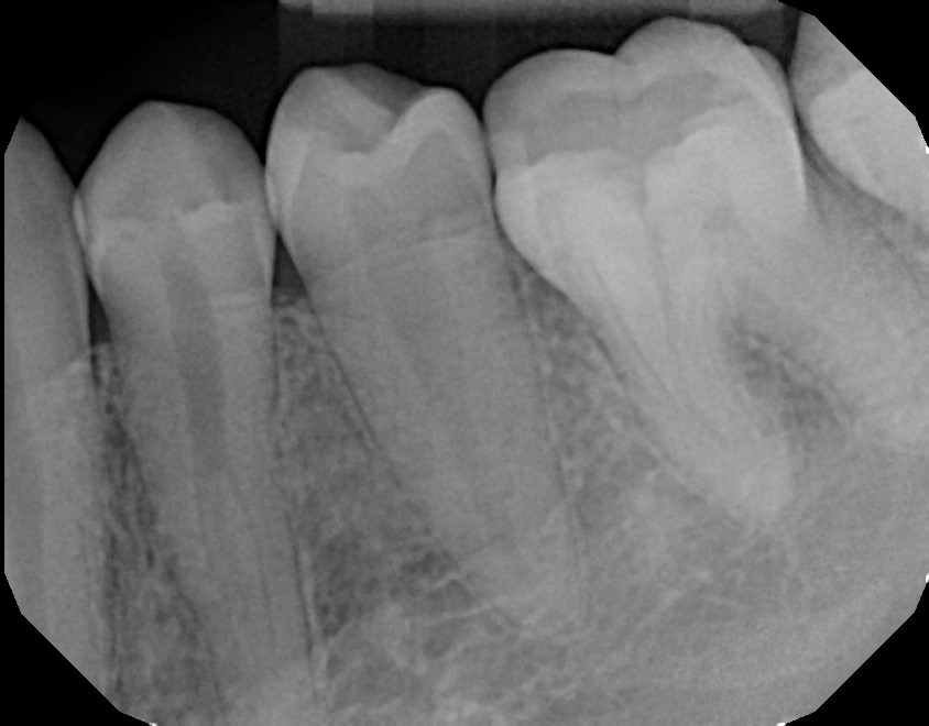 xrays of my teeth 11