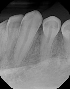 xrays of my teeth 12