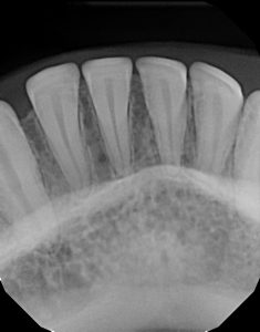 xrays of my teeth 13