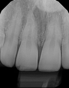 xrays of my teeth 16