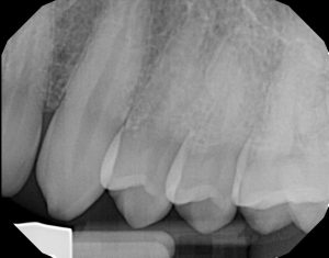 xrays of my teeth 17