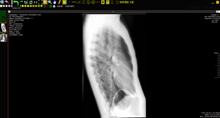 x-ray viewing program screenshot
