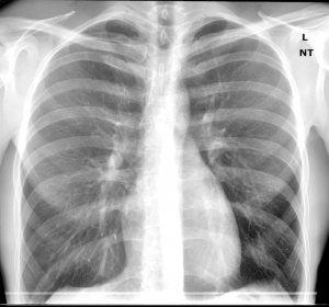 front xrays 2015 oct