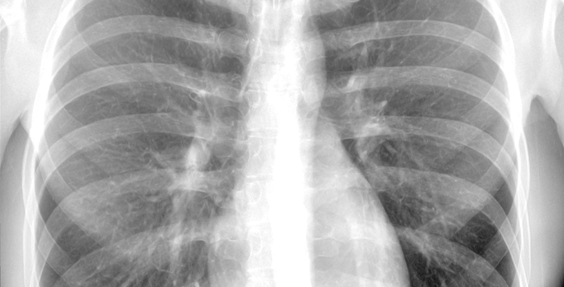 front xrays 2015 oct