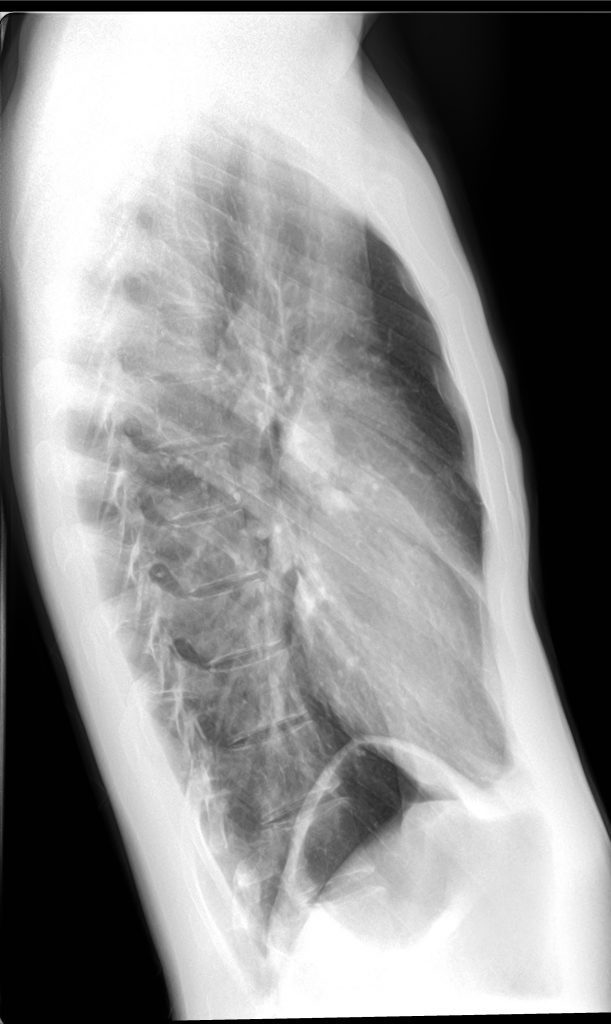 side xrays 2015 nov