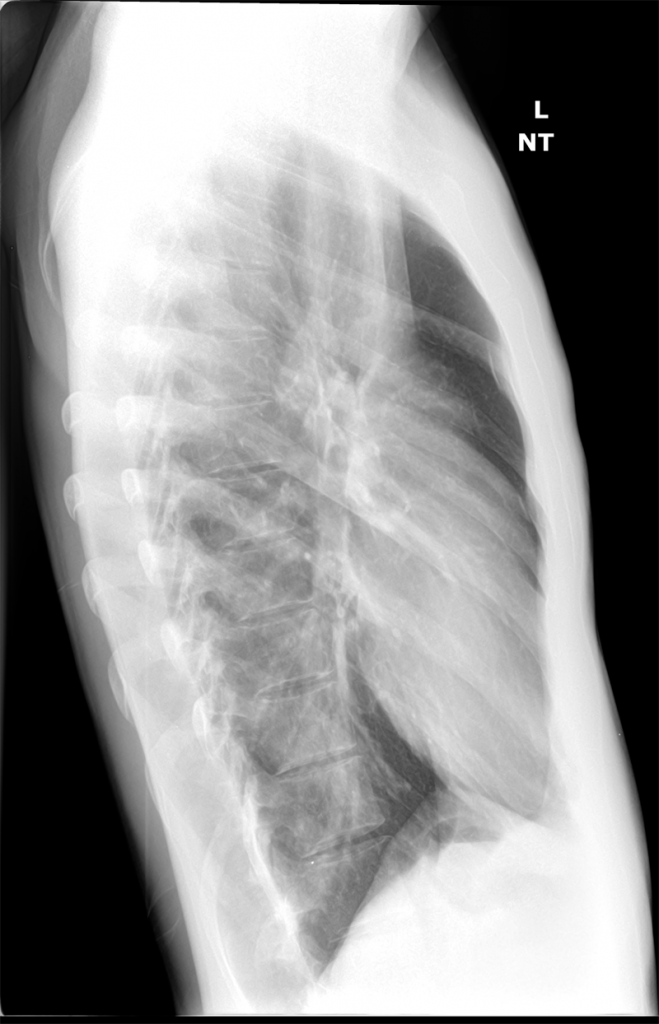 side xrays 2015 oct