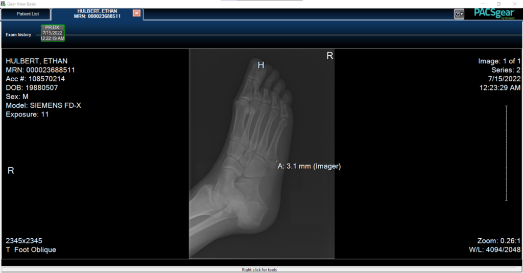 gear view x-ray bone viewing medical software screenshot
