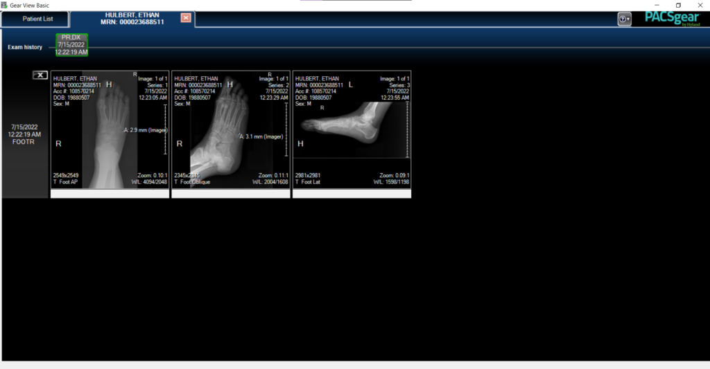 gear view x-ray program screenshot selection